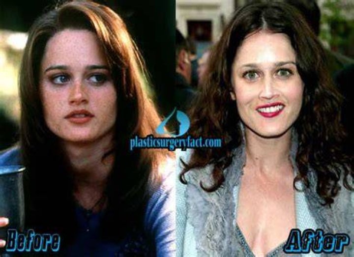 Robin Tunney's Face Accident: What You Need to Know About the Incident and Its Impact