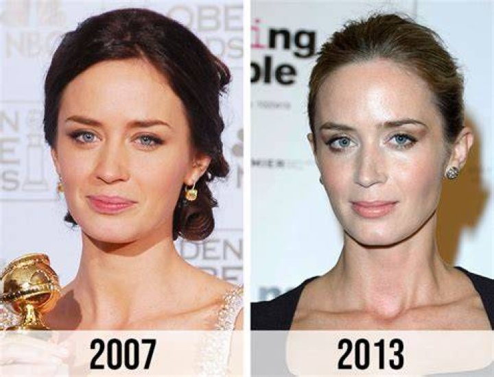 Understanding Emily Blunt's Deafness: Myths, Facts, and Her Journey